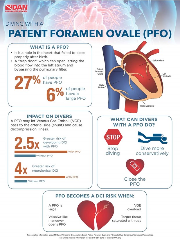 Información PFO de DAN