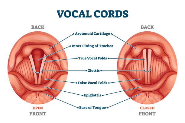 Cuerdas vocales